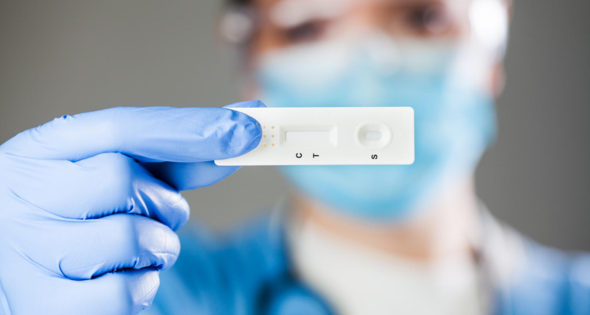 Las farmacias afirman que el precio de los test de antígenos viene `doblado en origen`